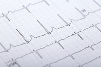 Medizinische Diagnostik EKG | Neue Praxis Albersweiler